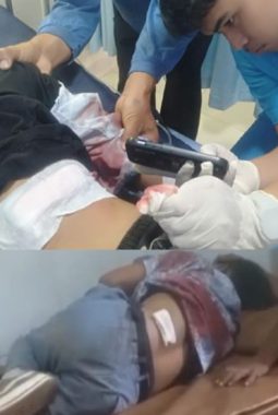 Pelajar SMA Diserang Saat Berangkat Sekolah, Diduga Jadi Korban Pembegalan di Bumi Nabung